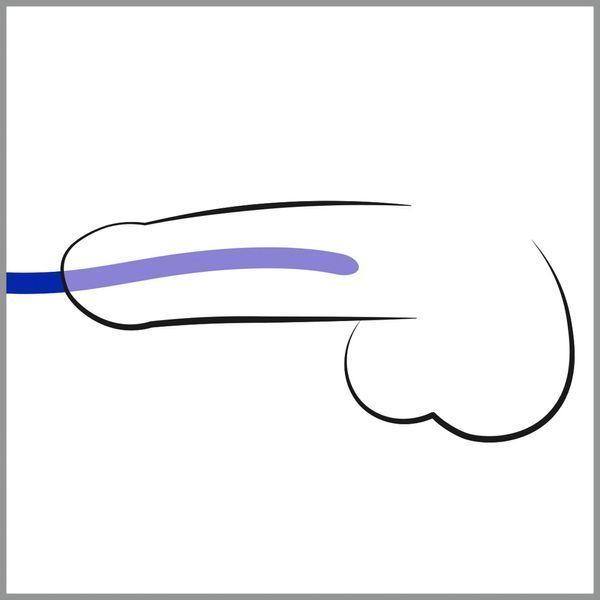 Стимулятори уретри Silikon Dilator Set 42-05221390000 фото